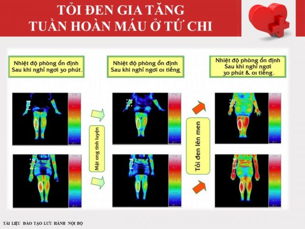 Tinh Chất Tỏi Đen DLC Black Garlic Formula Lọ 60 Viên - Tinh Chất Tỏi Đen Lên Men Nhật Bản, Giúp Ổn Định Huyết Áp, Hỗ Trợ Lưu Thông Máu, Tăng Tuần Hoàn Máu Não, Bảo Vệ Tim Mạch, Phòng Cảm Cúm Và Viêm Xoang, Cải Thiện Sinh Lý Nam Nữ - Ảnh 6