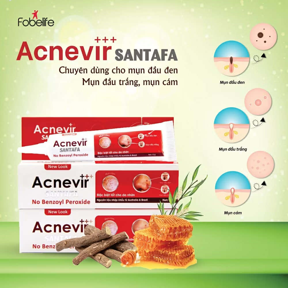 Kem Bôi Mụn ACNEVIR SANTAFA 15g - Giảm Mụn Cám, Mụn Đầu Đen - Ảnh 4