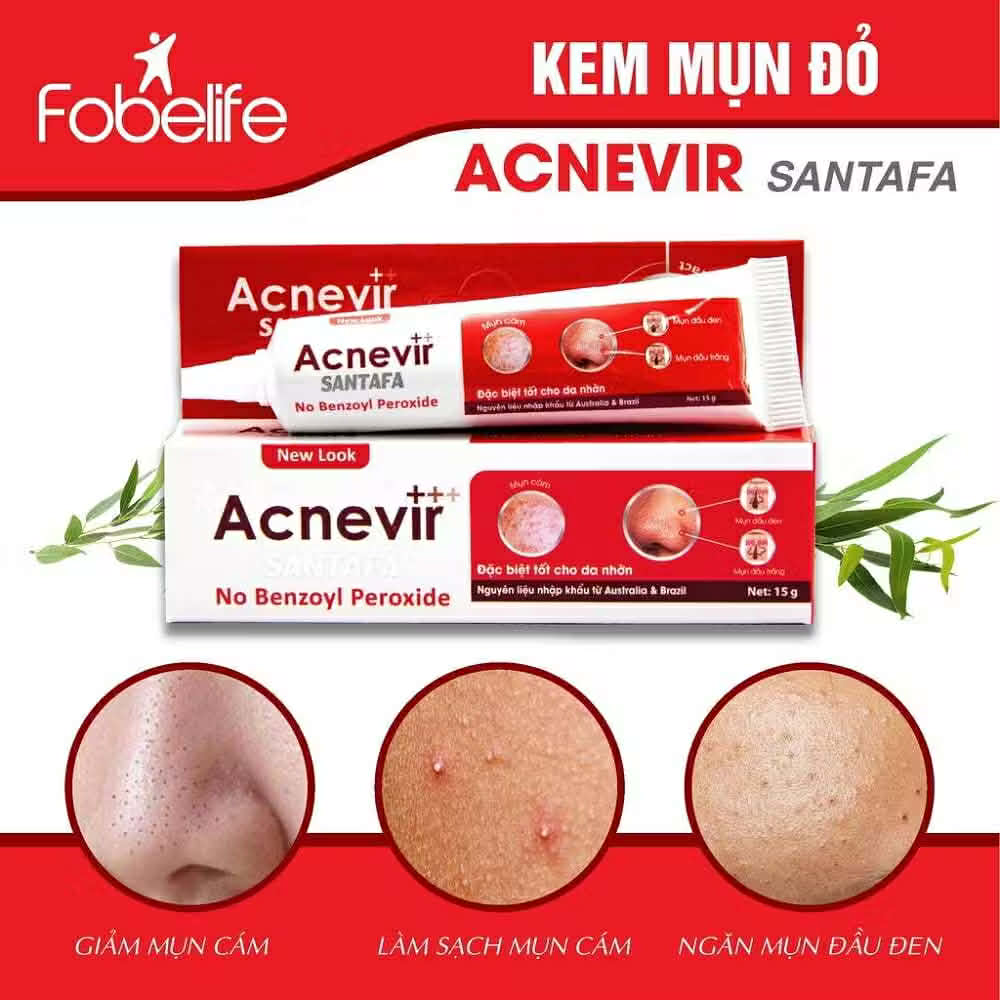 Kem Bôi Mụn ACNEVIR SANTAFA 15g - Giảm Mụn Cám, Mụn Đầu Đen - Ảnh 3