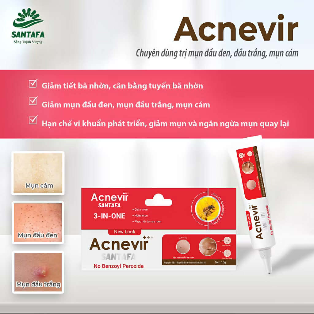 Kem Bôi Mụn ACNEVIR SANTAFA 15g - Giảm Mụn Cám, Mụn Đầu Đen - Ảnh 2